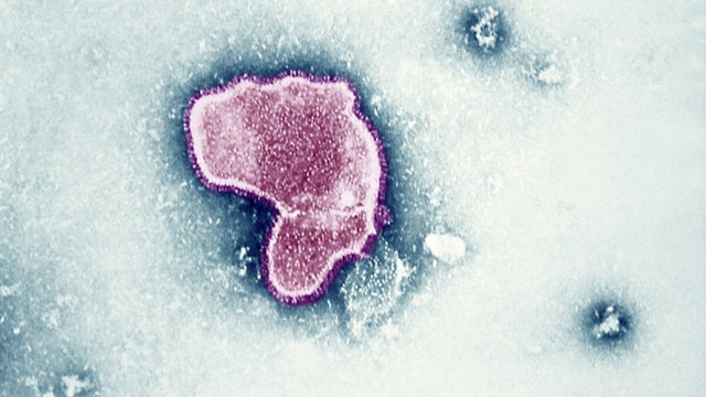 Thic Electron Micrograph Reveals The Morphologic Traits Of The Respiratory Syncytial Virus Rsv. The Virion Is Variable In Shape, And Size Average Diameter Of Between 120 300Nm. Rsv Is The Most Common Cause Of Bronchiolitis And Pneumonia Among Infants And Children Under 1 Year Of Age.