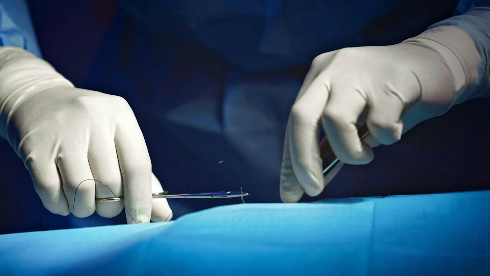Detail of the surgeon's hands during the operation.