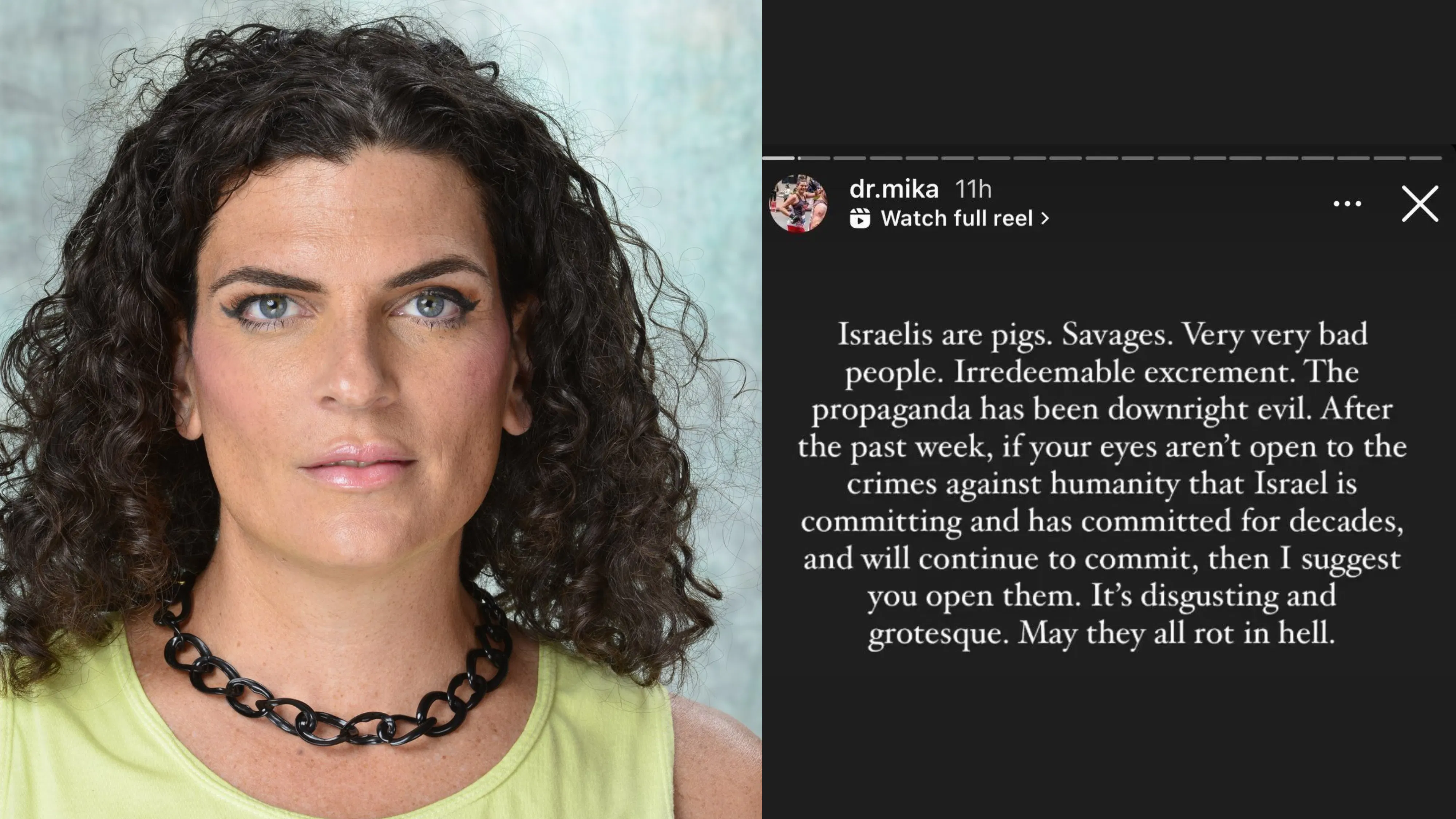 Professor Who Called Israelis ‘Pigs’ And ‘Irredeemable Excrement’ No Longer Employed, School Confirms