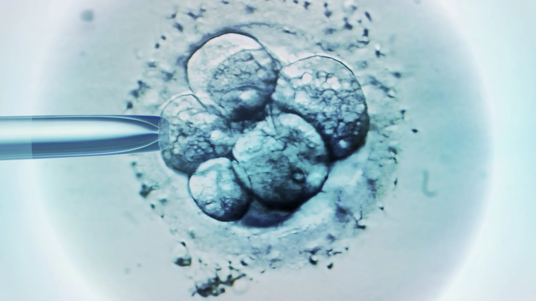 Alabama Supreme Court Says Couples Can Continue Wrongful Death Lawsuit Over Destruction Of Frozen Embryos