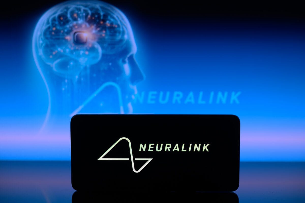 NextImg:Neuralink Posts Video Of First Human Patient Using Brain Chip To Play Chess With His Mind 