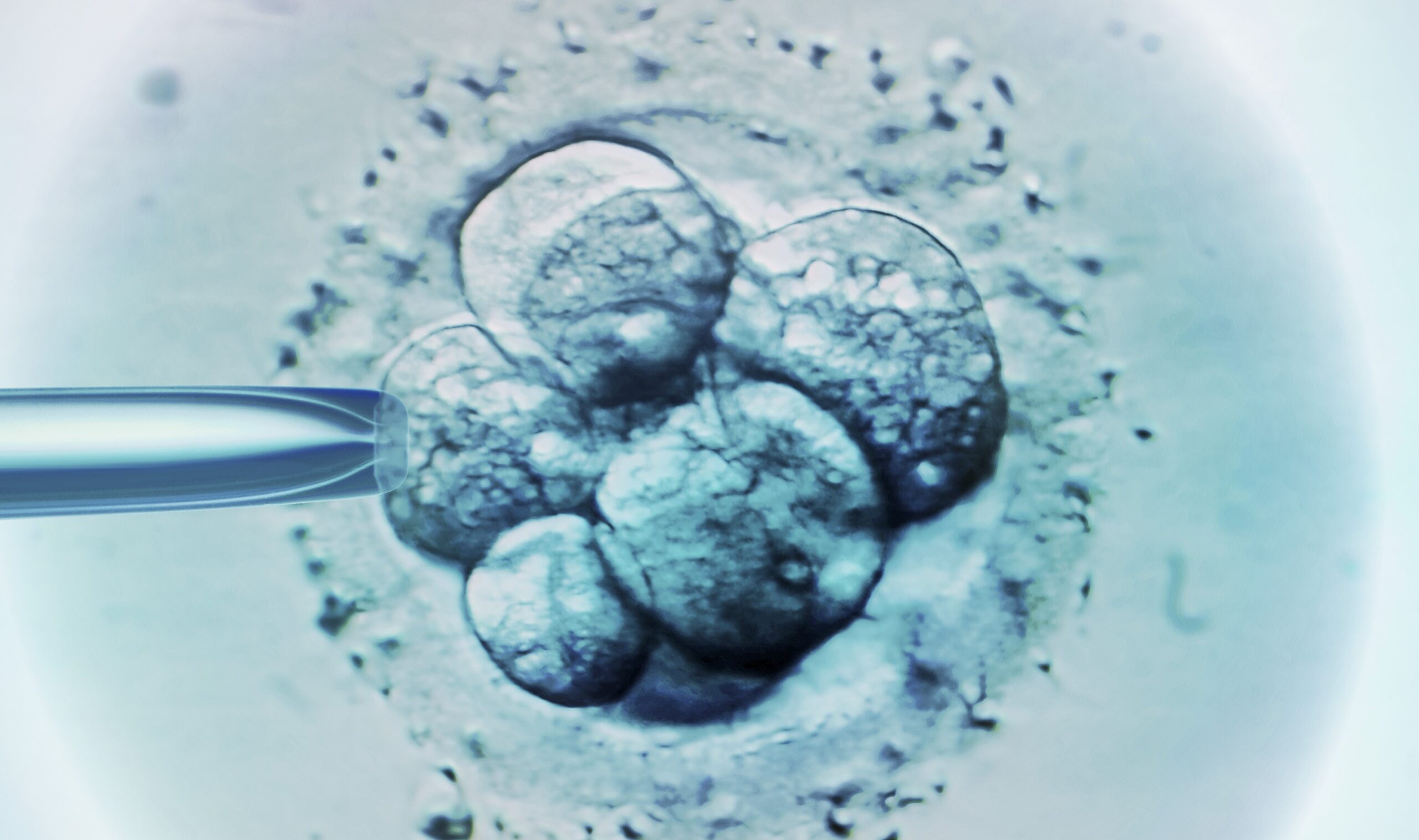 Nine Couples Sue Fertility Clinic For Allegedly Implanting ‘Dead Embryos’ During IVF Procedures