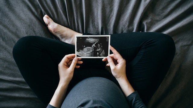 d3sign. Getty Images. High angle shot of Asian pregnant woman holding an ultrasound scan photo in front of her baby bump, sitting on bed at home. Mother-to-be. Precious moment in life. Preparation for a new family member. Expecting a new life. Baby and new life concept