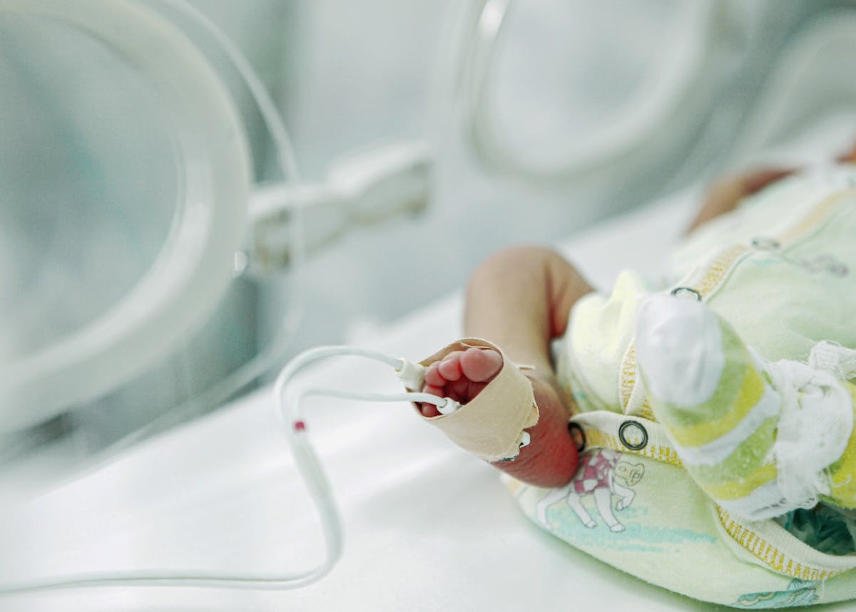 Most Premature Baby Ever Celebrates First Birthday, Declared Guinness World Record Holder