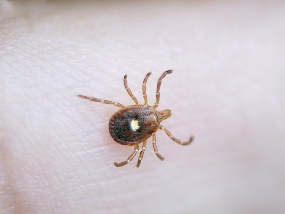 New Jersey Man Dies From A Meat Allergy Caused By Tick Bite