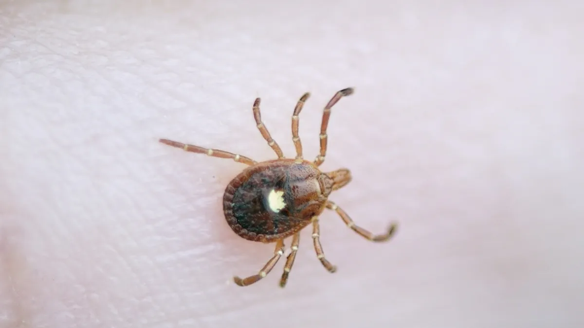 New Jersey Man Dies From A Meat Allergy Caused By Tick Bite