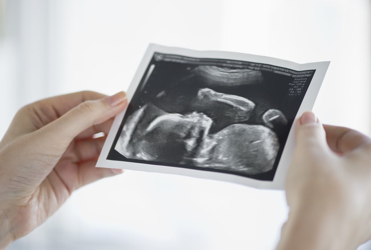 Scotland May Soon Allow Abortions Up To Birth For ‘Social Reasons’