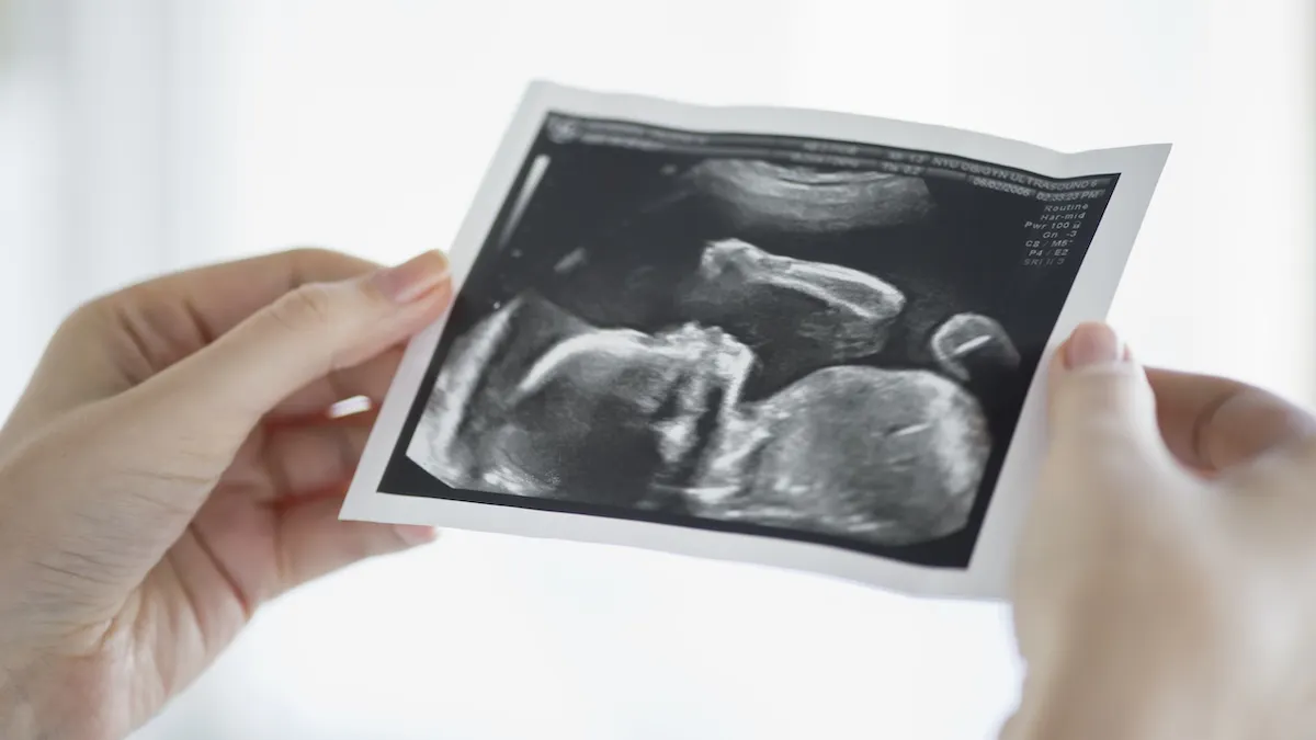 Scotland May Soon Allow Abortions Up To Birth For ‘Social Reasons’