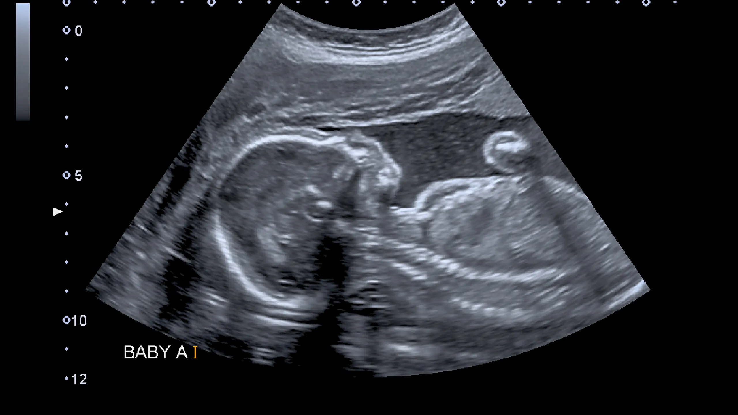 She Didn’t Order The Abortion Pills. Yet They Showed Up At Her Front Door.