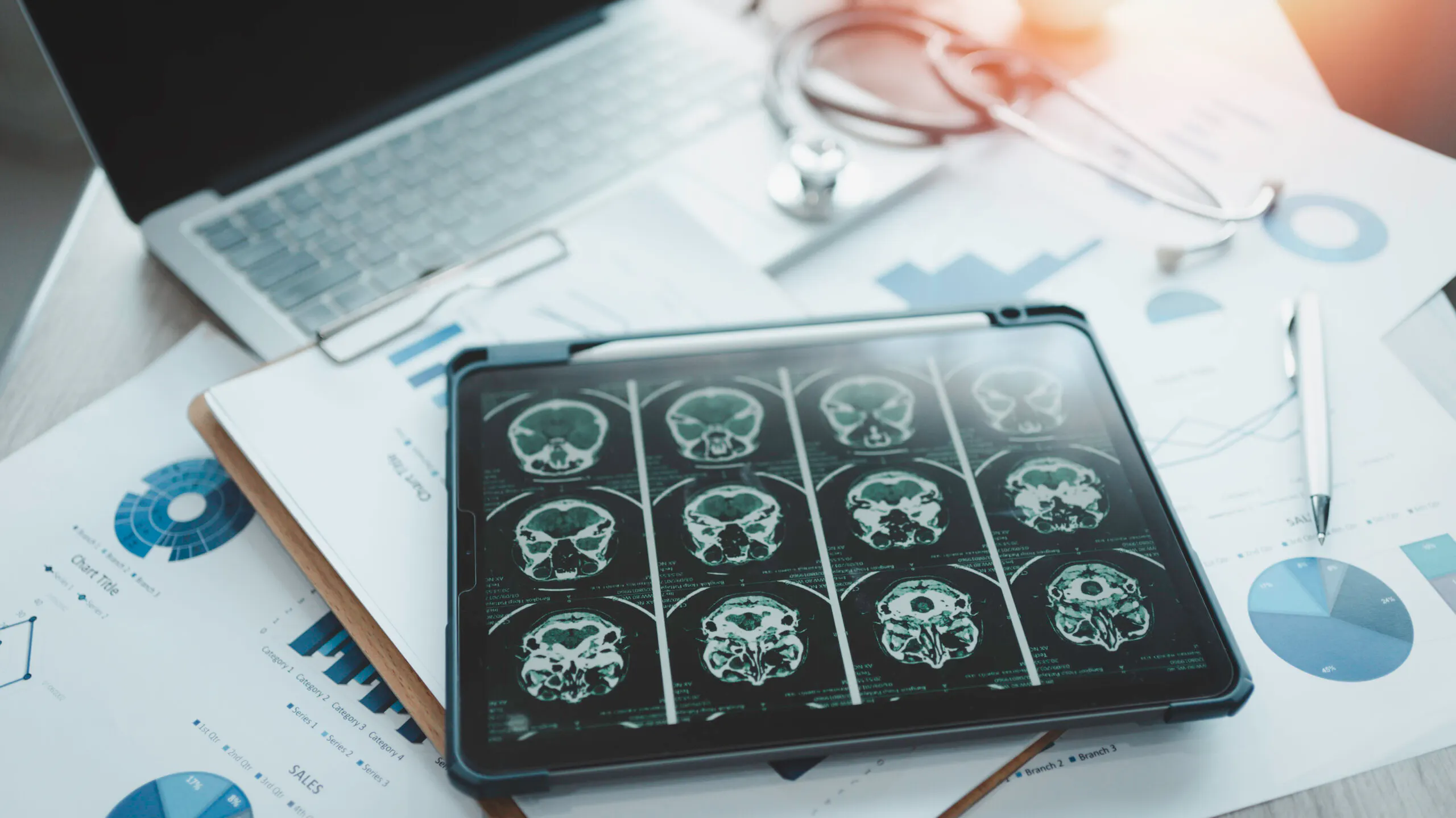 A Simple Spray Could Treat Dementia