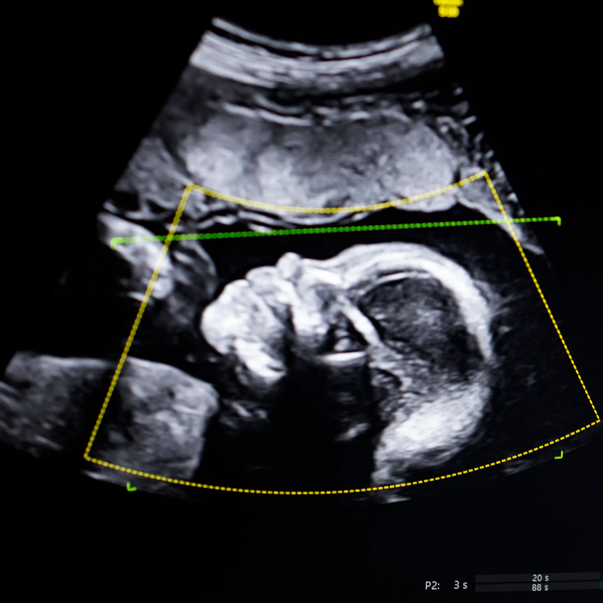 The History Behind This Abortion Law Reveals Who It Was Built To Target