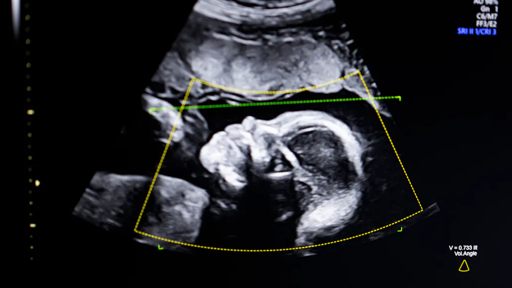 Radical Abortion Group Hit With State Lawsuit For Pushing Illegal Drugs