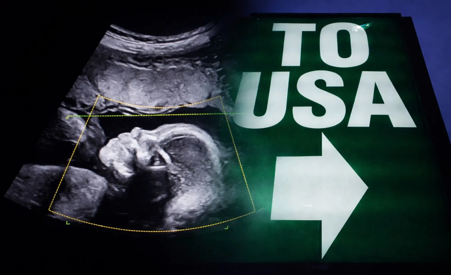 America’s Birth Trend Sparks Alarm As A Controversial Slice Nears 1 In 10