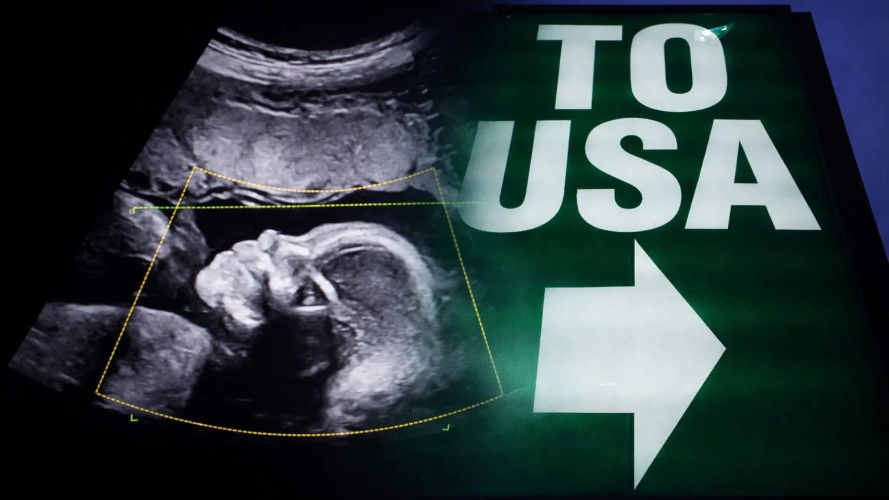 America’s Birth Trend Sparks Alarm As A Controversial Slice Nears 1 In 10