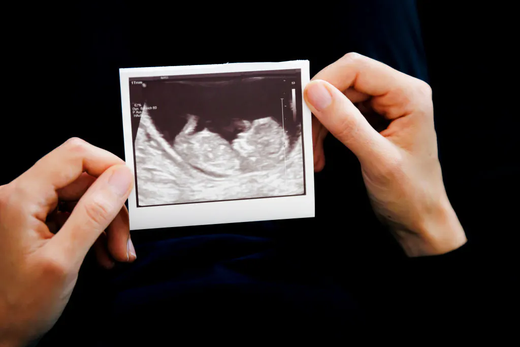 Being Pro-life Can Turn The Cruelest Circumstances Into Hope And Love