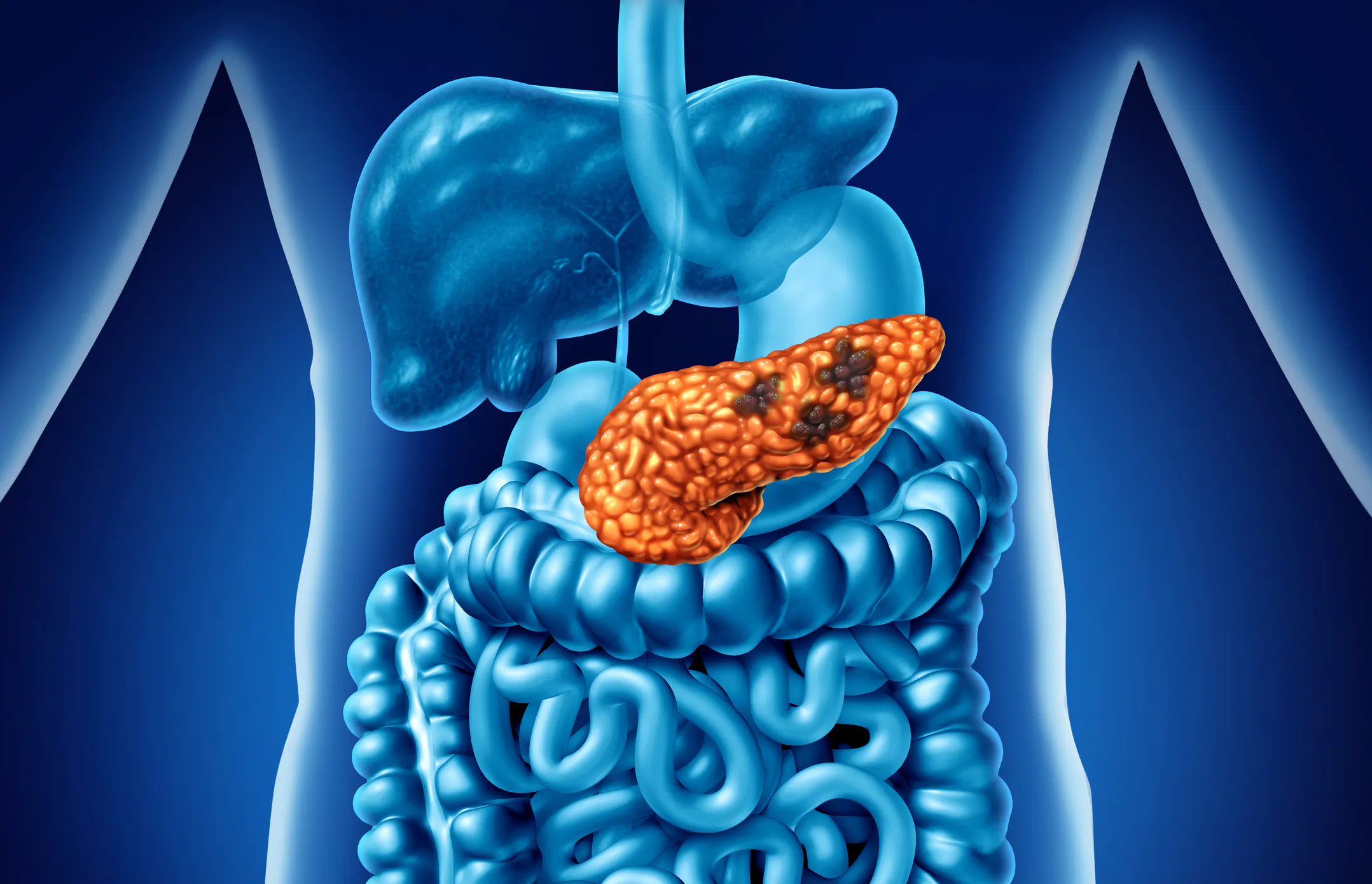 GAME CHANGER: AI Detects Silent Killer Cancer 3 Years Before Diagnosis