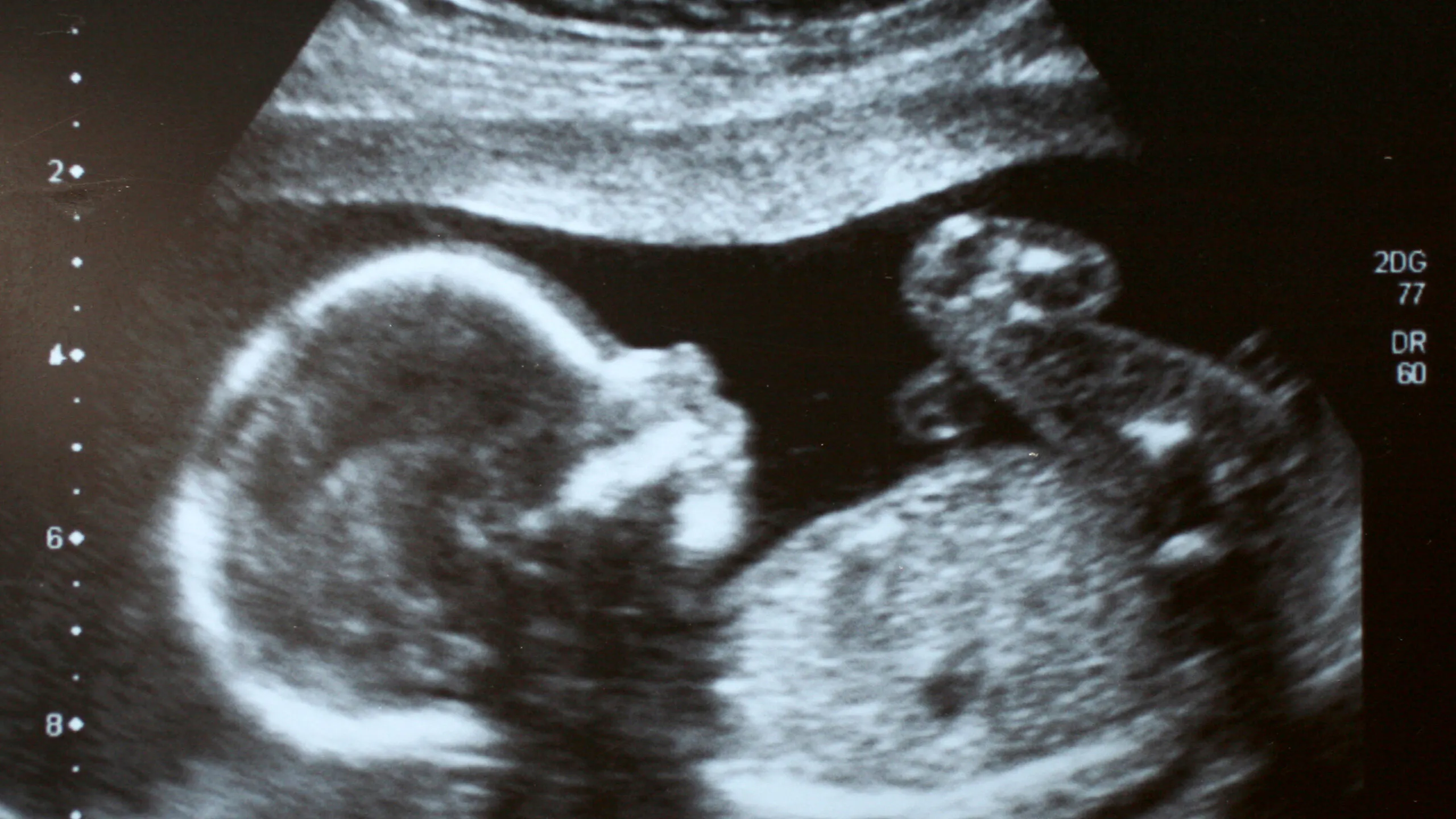 Abortion Drugs Now Arrive As Fast As An Amazon Package