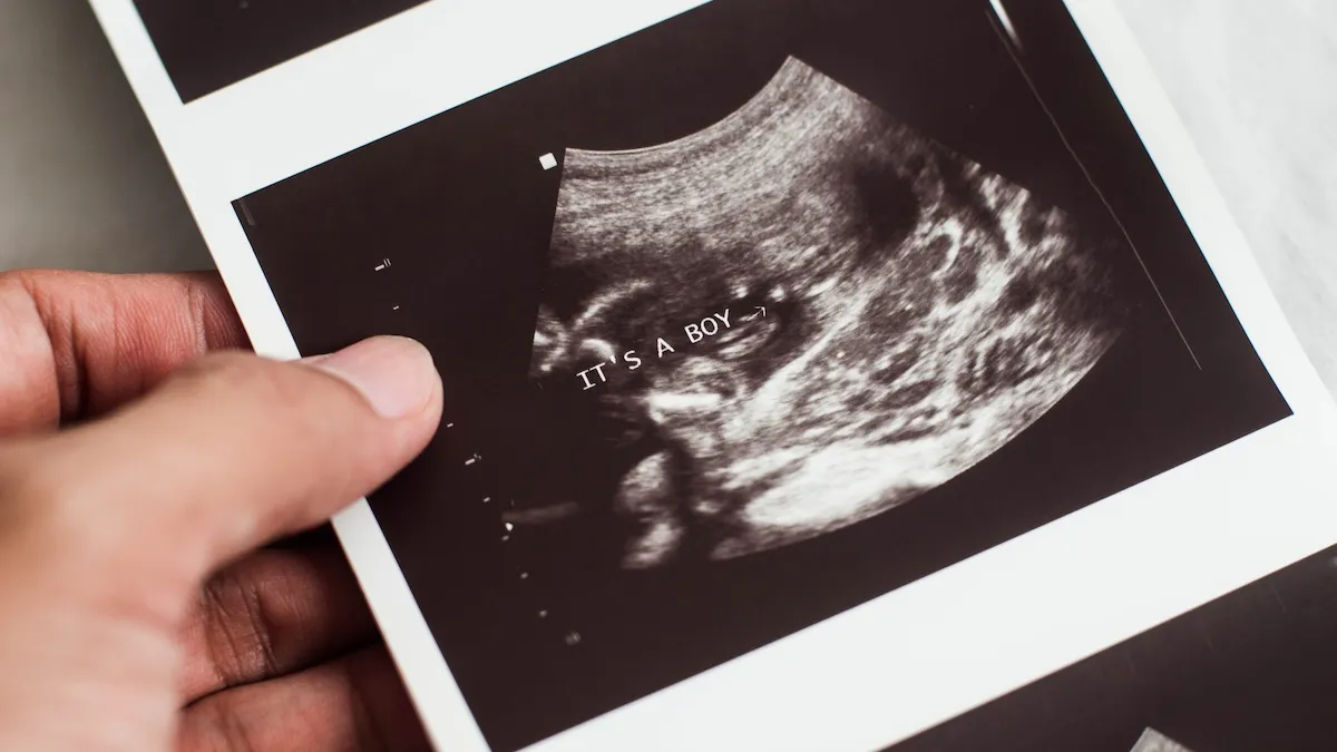 He Thought He Was Defending Abortion. Instead, He Exposed It.