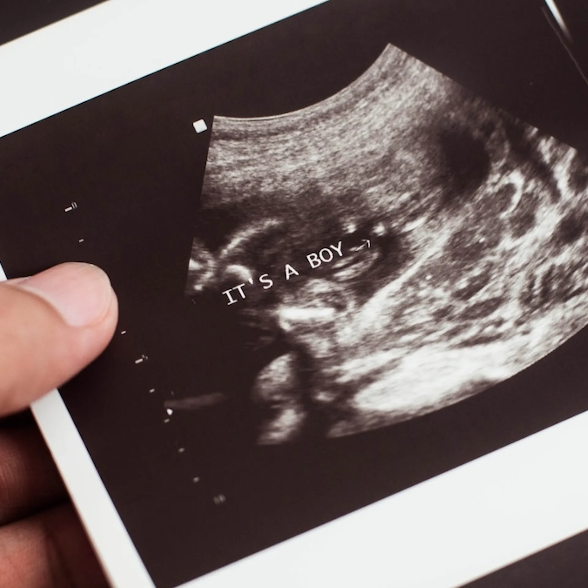 He Thought He Was Defending Abortion. Instead, He Exposed It.
