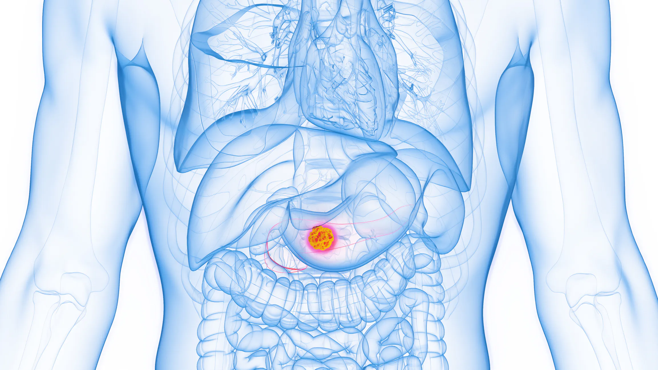 Popular ‘Healthy’ Fat Found To Fuel Deadly Pancreatic Cancer