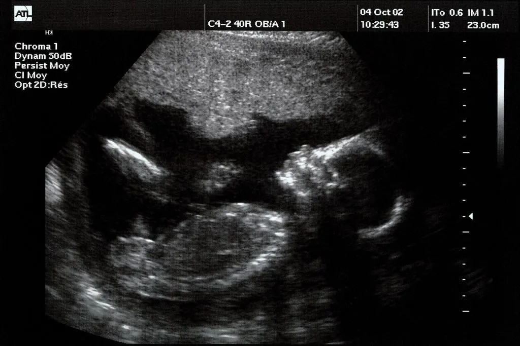 America’s Fertility Crisis Has Astonishing New Link to iPhones, Study Finds