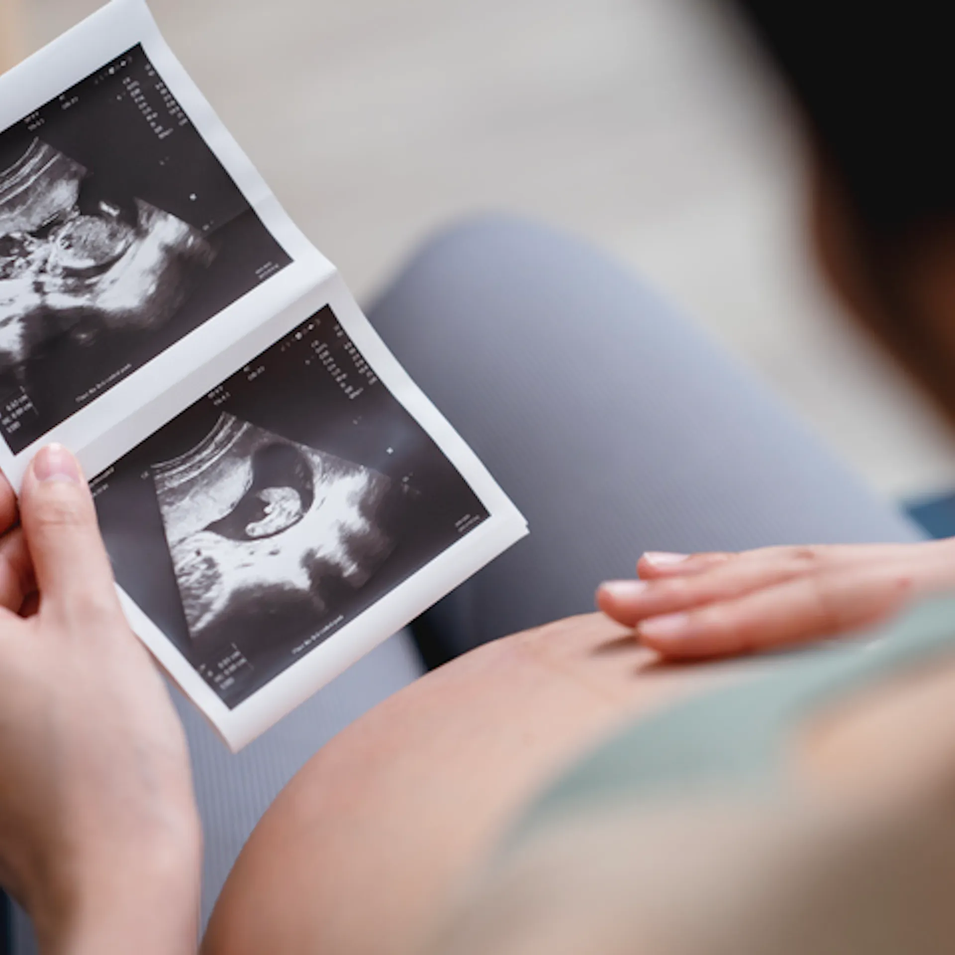 Making America Healthy Means Ending The Abortion Pill