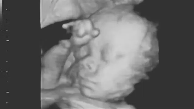 Surrogate Baby Saga Takes Dark New Turn After Mom Chose Life