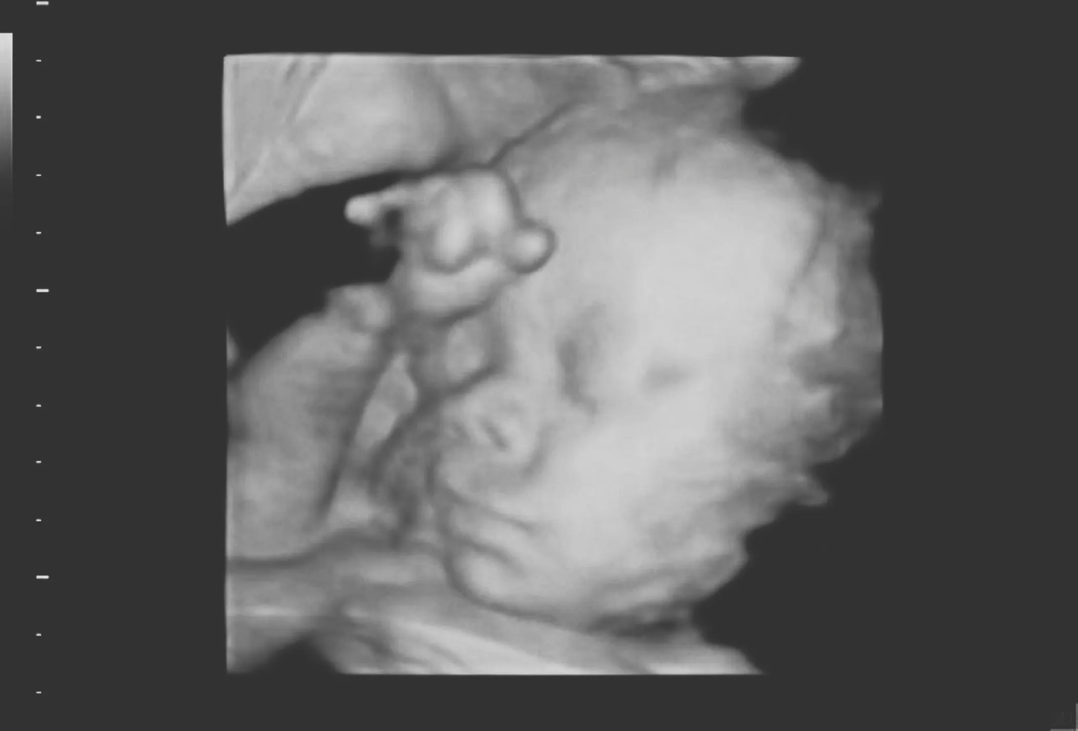 WATCH: Crowd Laughs As Dem Governor Allows Abortion Until Birth