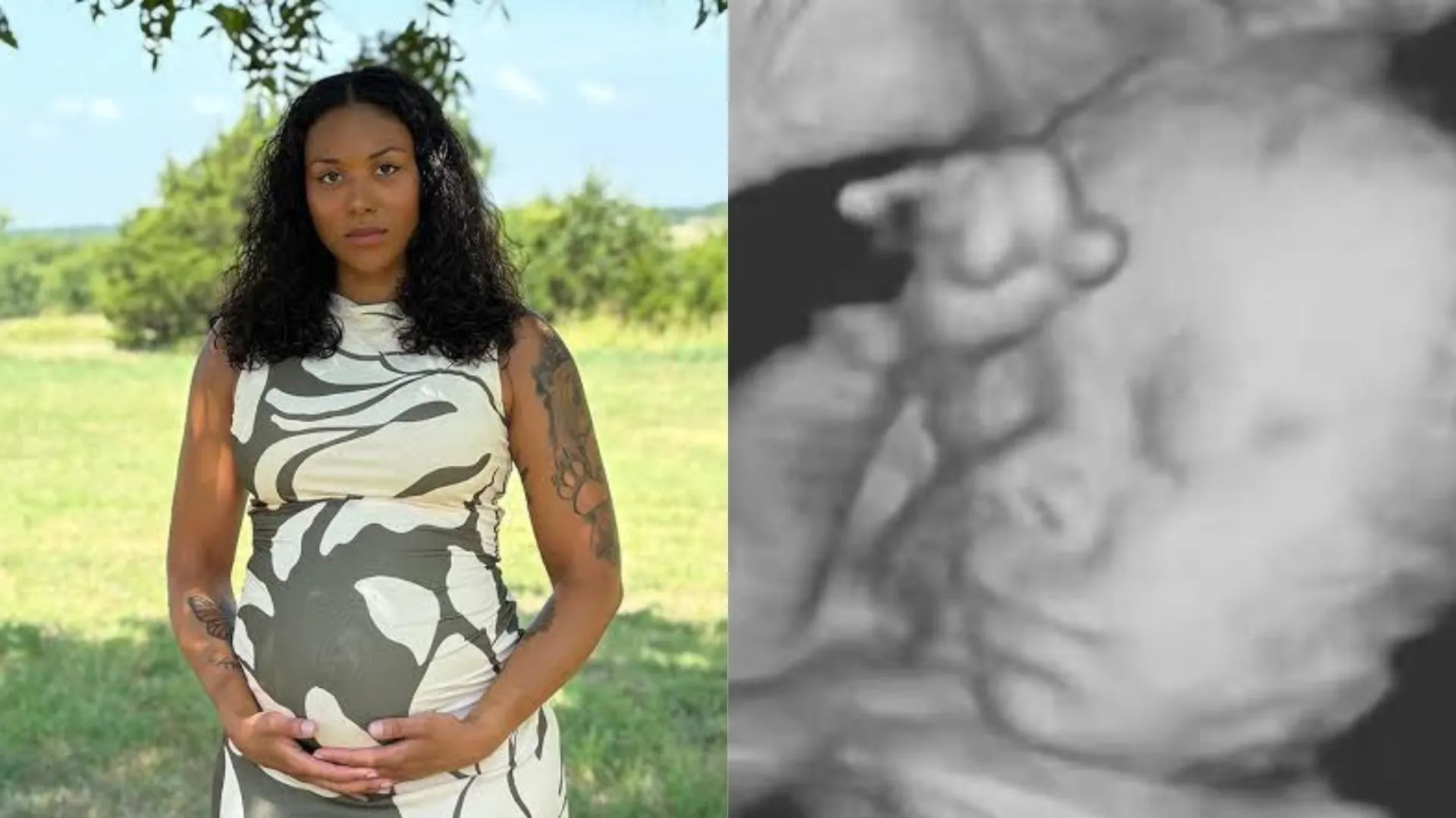 Surrogate Who Refused Abortion Takes Nasty Custody Battle To Supreme Court