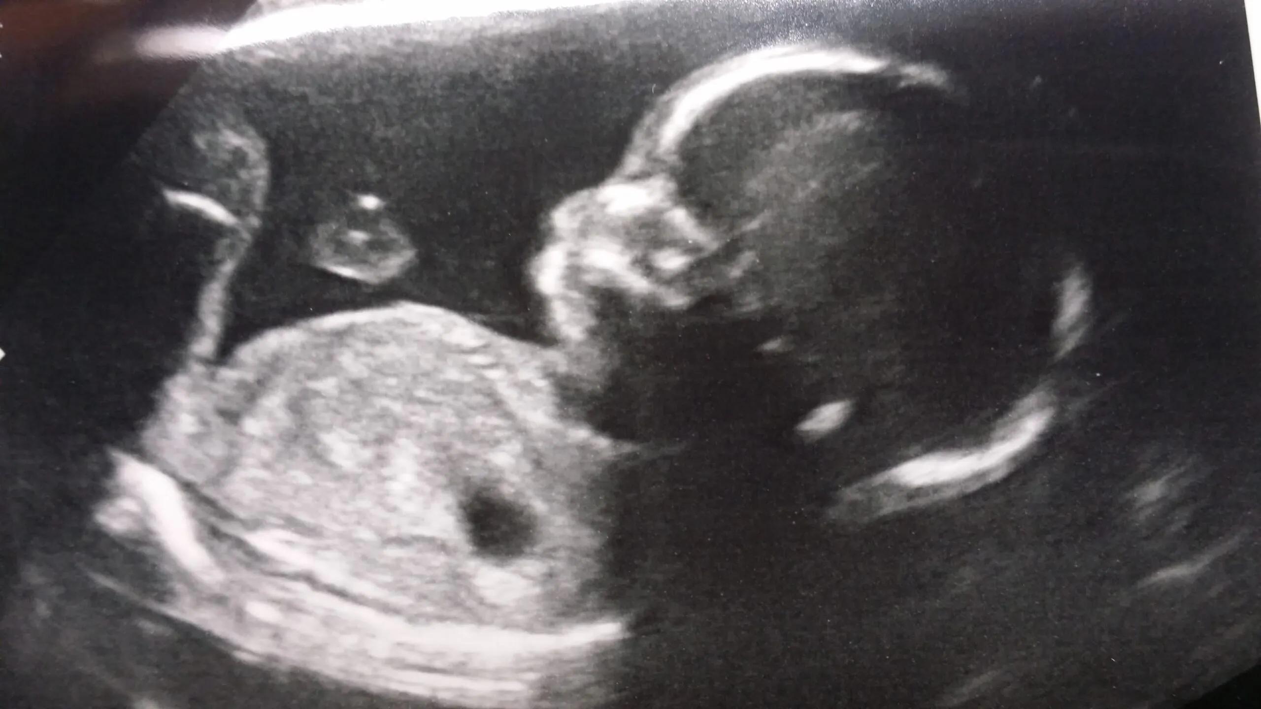 The Thing America Lost Before It Stopped Having Babies