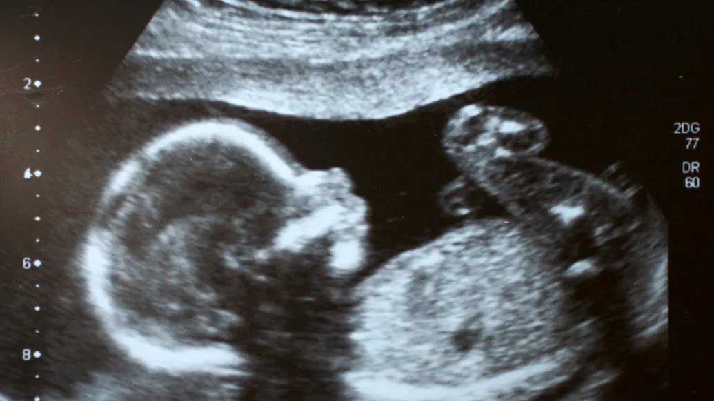 Federal Pro-Life Protection Hits Major Milestone As New Attacks Emerge