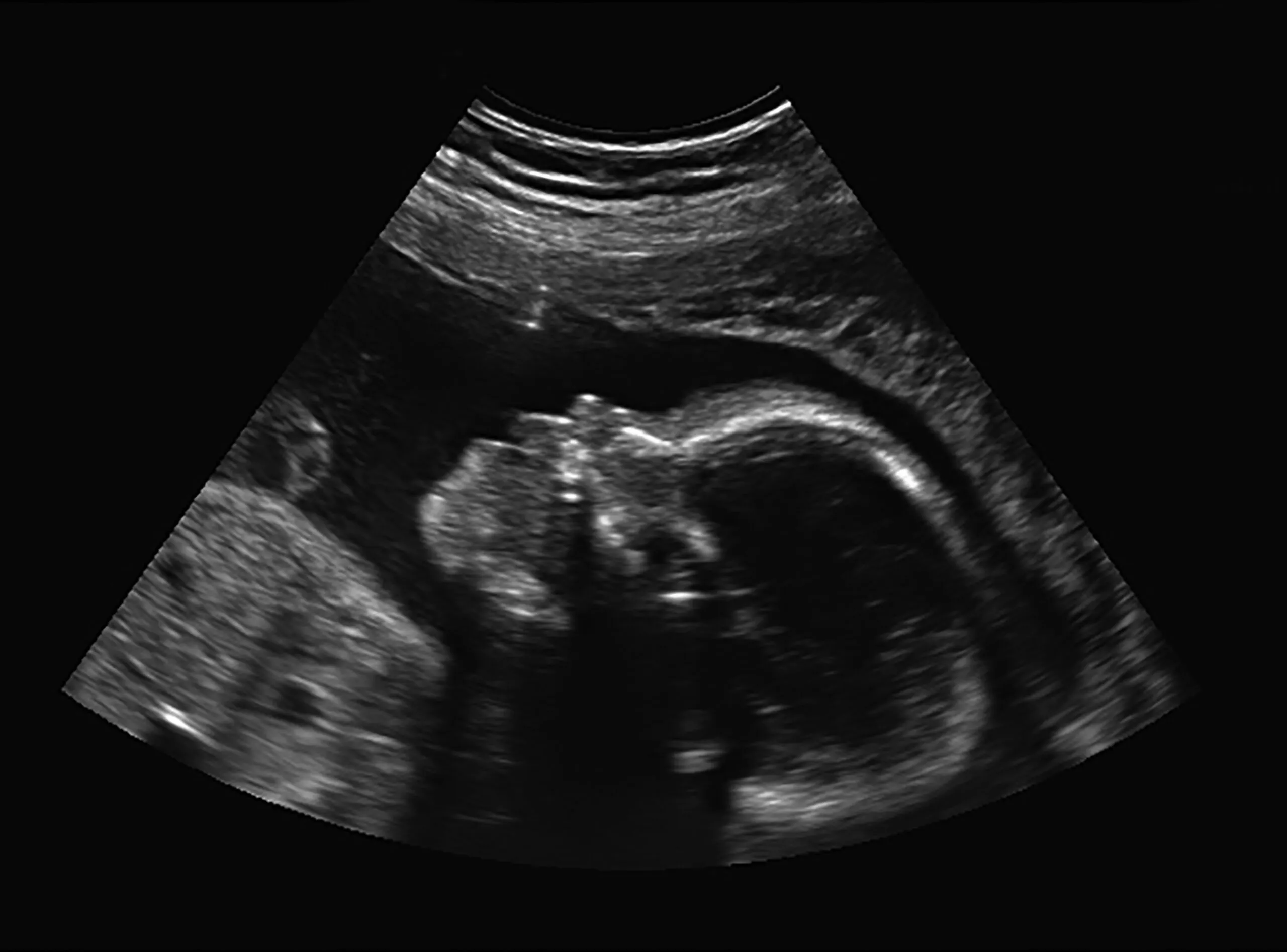 Inside The Government Decision That Opened Up Abortion Pill Floodgates